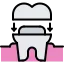 29 implant, crown, tooth, dentist, dental, medicine
