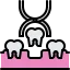 34 removal, pulling, forceps, tooth, dentist, dental, medicine