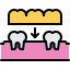 37 implant, crown, tooth, dentist, dental, medicine