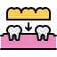 37 implant, crown, tooth, dentist, dental, medicine